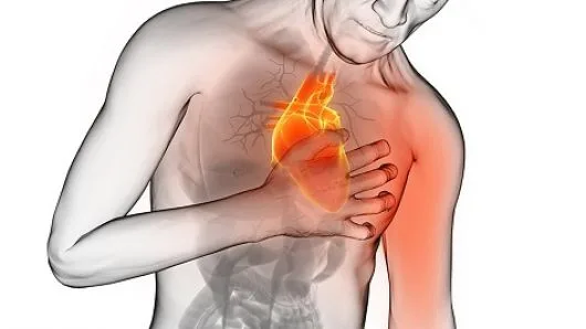 Per. salud 0010-14 infarto