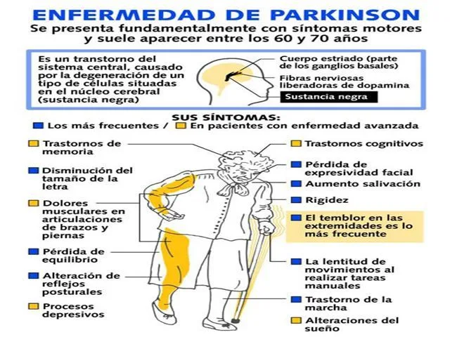 parkinson va